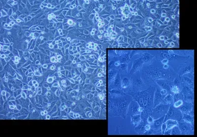 cells frozen with new cryoprotectant